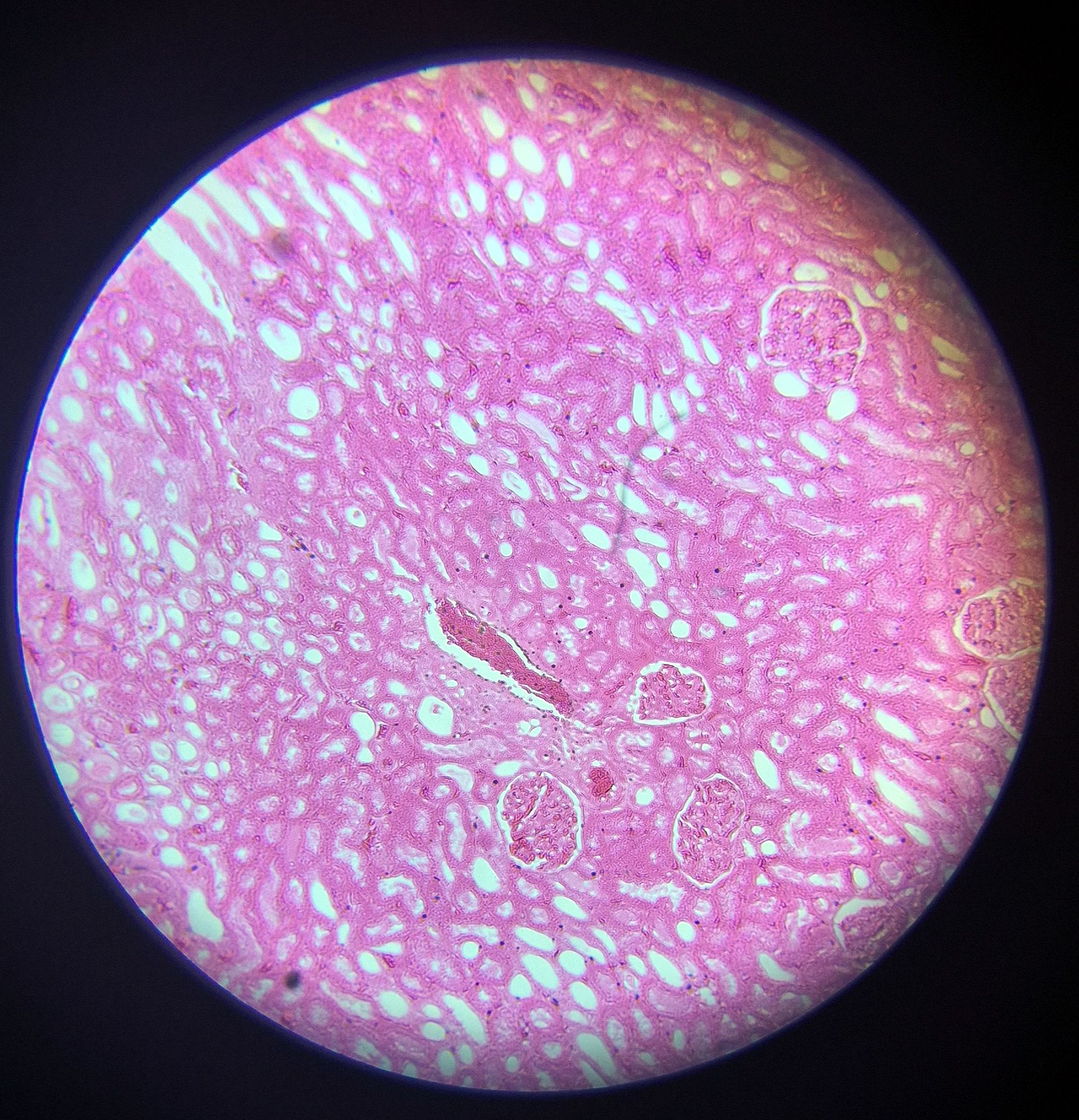 no-87-rein-l-s-kidney-of-l-s